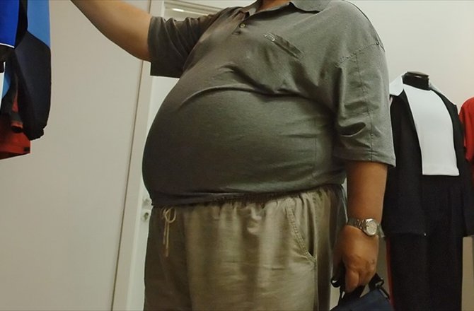 'DÜNYA NÜFUSUNUN ÜÇTE BİRİ OBEZ'