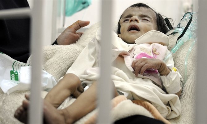 Yemen'de her yıl 66 bin çocuk ölüyor