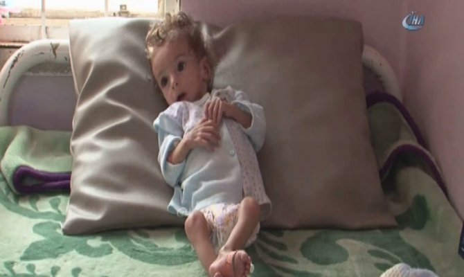 Yemen kıtlık tehlikesiyle karşı karşıya