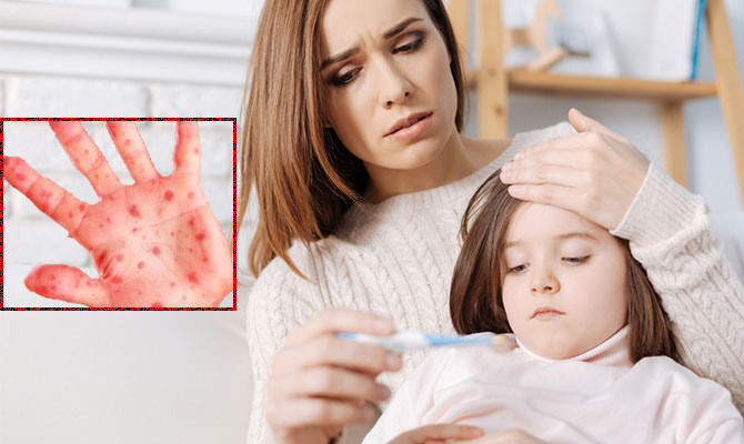 Çocuklarda ki bu hastalık panik yaratıyor!