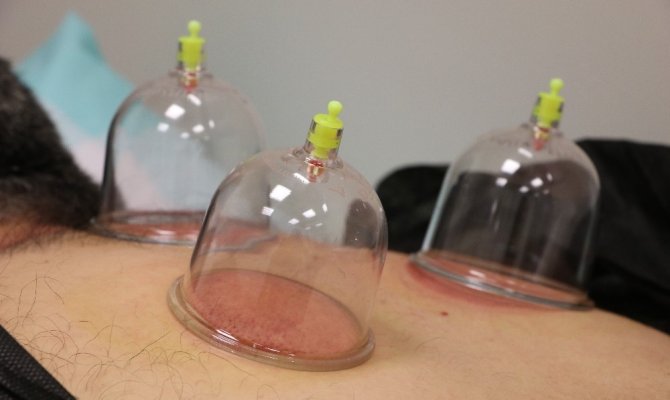 Hacamat ve Akupunktur'un yeni adresi şehir hastanesi