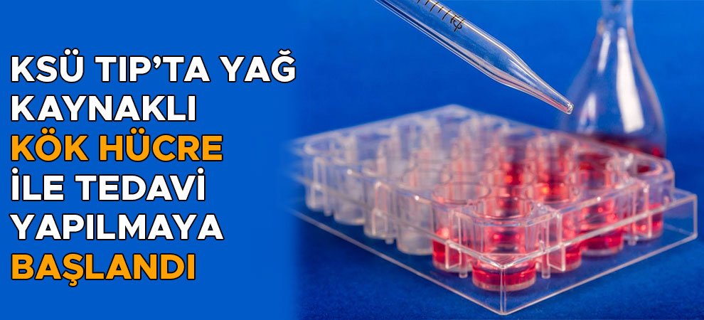 KSÜ Tıp’ta Yağ Kaynaklı Kök Hücre İle Tedavi Yapılmaya Başlandı