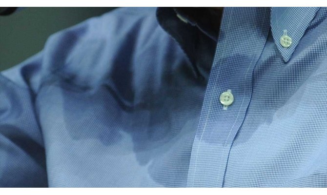 'Aşırı terleme sosyal izolasyona neden oluyor'