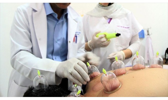 'Doğru yapılan hacamat kalıcı iz bırakmaz'