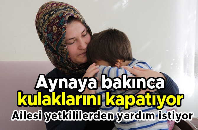 Aynaya bakınca kulaklarını kapatıyor