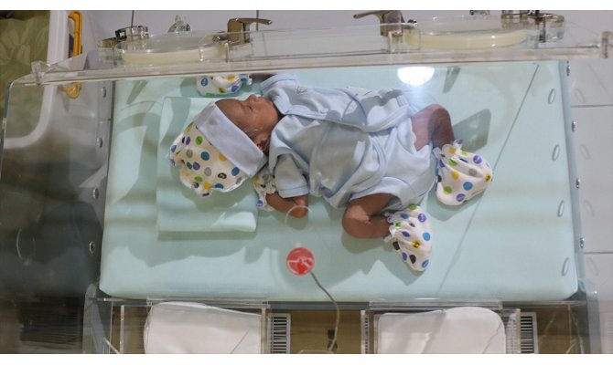 Her yıl 15 milyon bebek hayata erken başlıyor