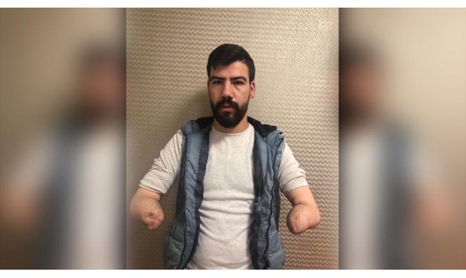 Yeni kollarıyla araba kullanmanın hayalini kuruyor