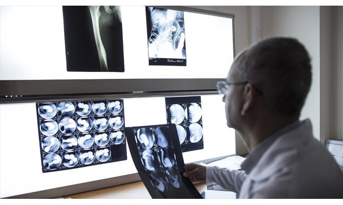 Sağlık hizmeti alan yabancılara 20 ülkedeki tanı merkezlerinden 'tedavi sonrası takip'