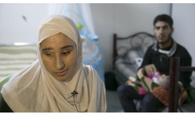 Bombardımanda gözlerini kaybeden anne bebeğinin kokusuyla avunuyor