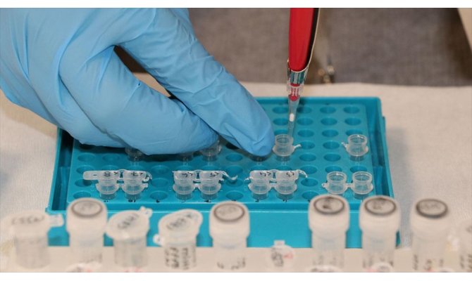 Adana'dan yurt dışına kanser testi hizmeti