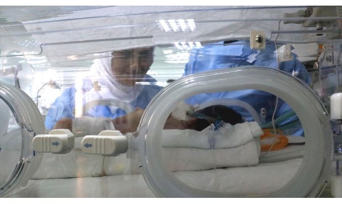 Mide ve bağırsakları dışarıda doğan bebek sağlığına kavuşturuldu