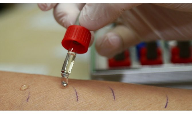 Dikkat, kış mevsiminde artıyor!