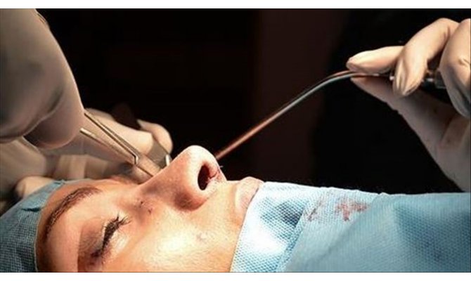 Sömestirde erkekler saç ekimi, kadınlar estetik yaptıracak