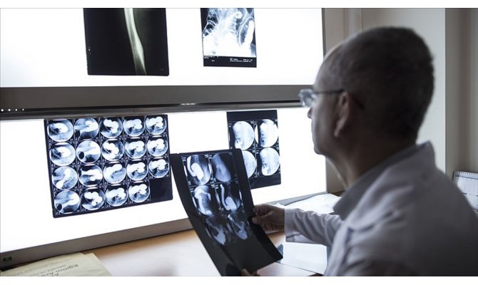 Meme kanserinde 'mamografi' hayat kurtarıyor