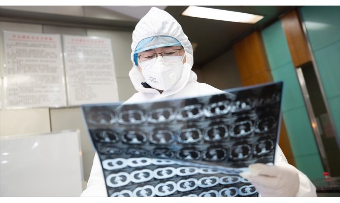 Çin’de yeni tip koronavirüs nedeniyle ölenlerin sayısı 637’ye çıktı