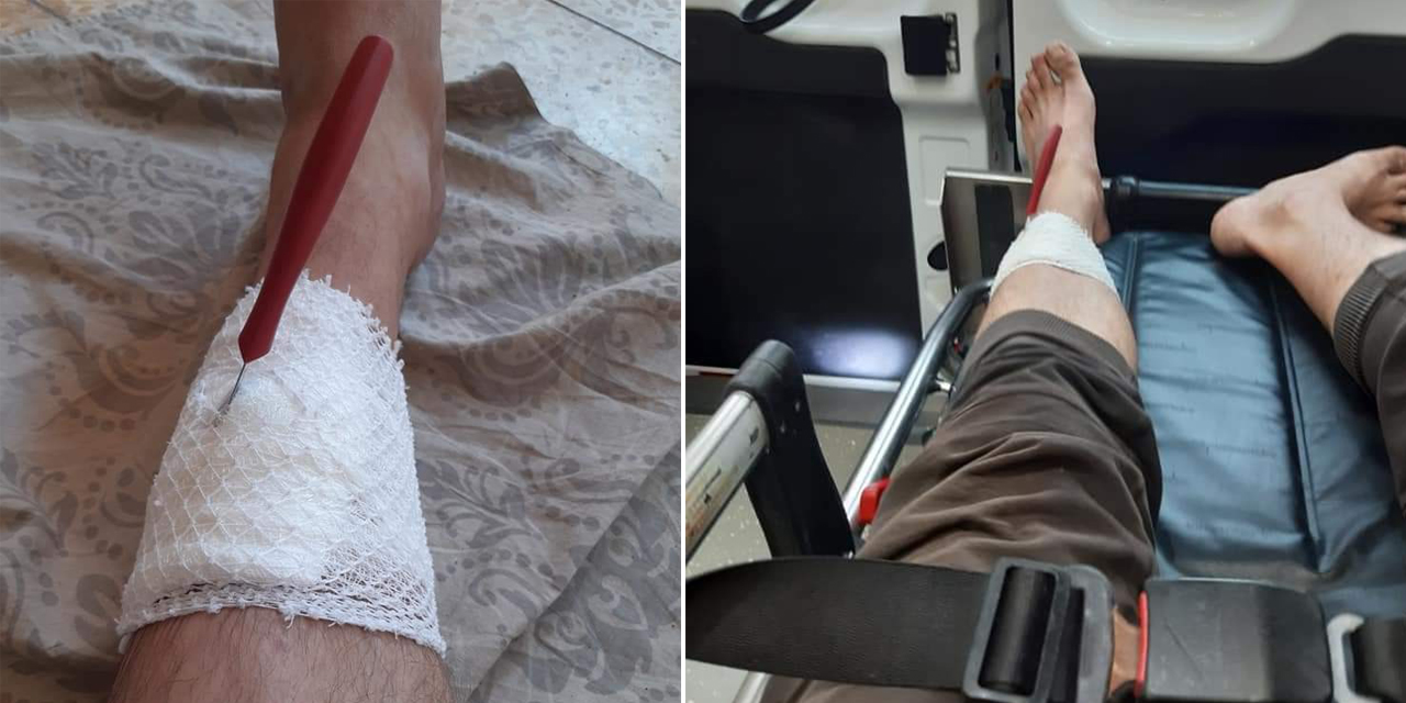 Kahramanmaraş’ta görünmez kaza! Bıçak baldırına sağlandı