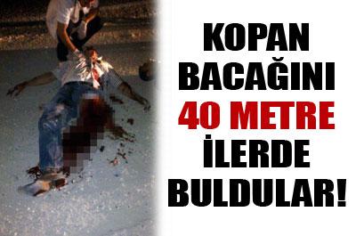 Kopan bacağı, 40 metre uzakta bulundu