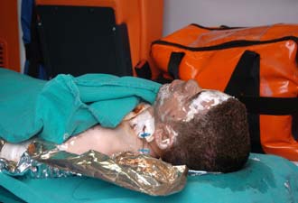 Yakıt Tankı Patladı Ve