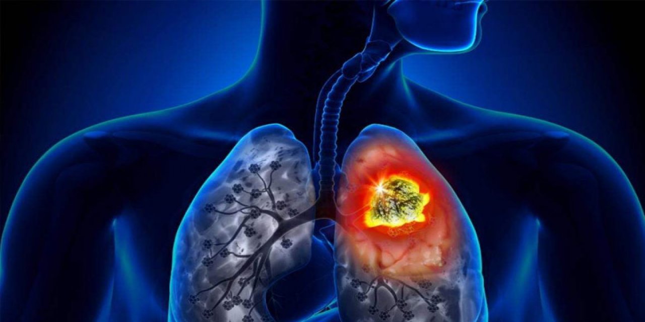 Akciğeri güçlendiren 10 önemli besin!