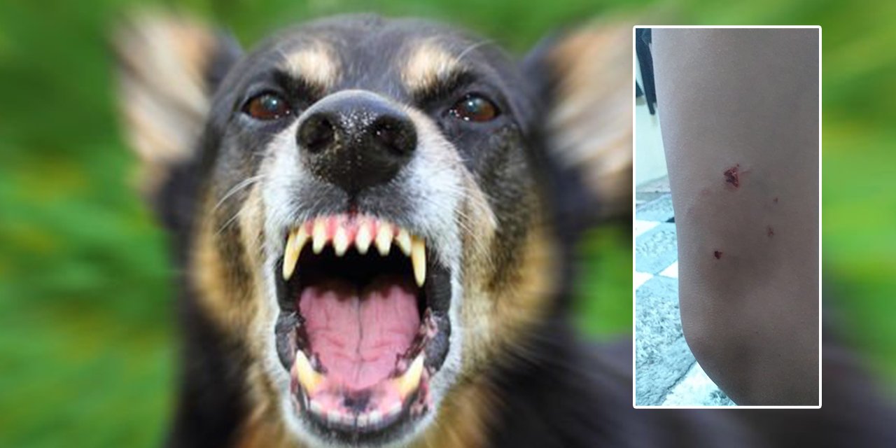 Kahramanmaraş’ta 11 yaşındaki çocuk köpek saldırısına uğradı