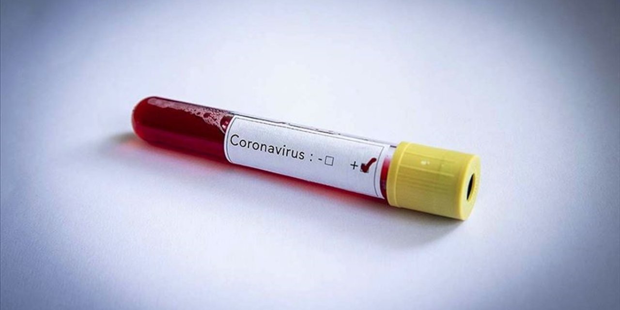 Kovid-19 tedavisinde 'hidroksiklorokin' ilacı kullanılmayacak