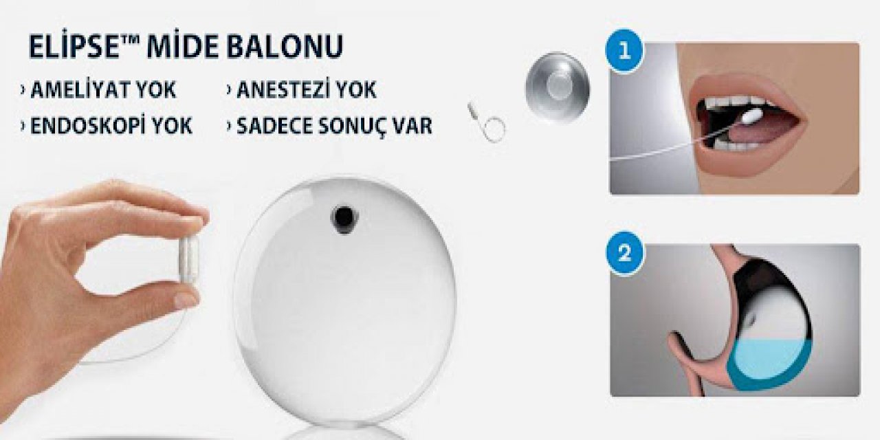 Yutulabilen kapsülle teşhiste endoskopiye gerek kalmayacak