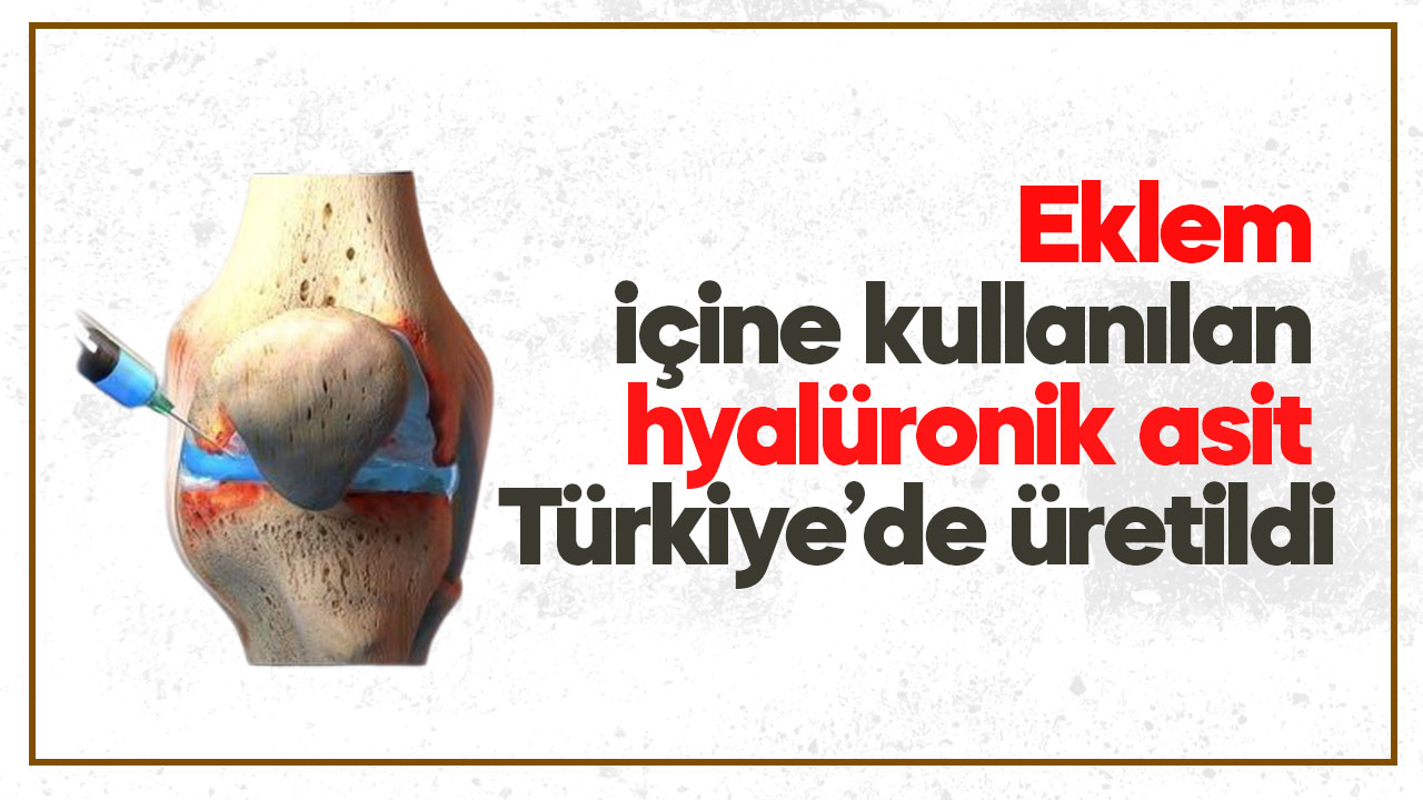 Eklem içine kullanılan hyalüronik asit Türkiye’de üretildi