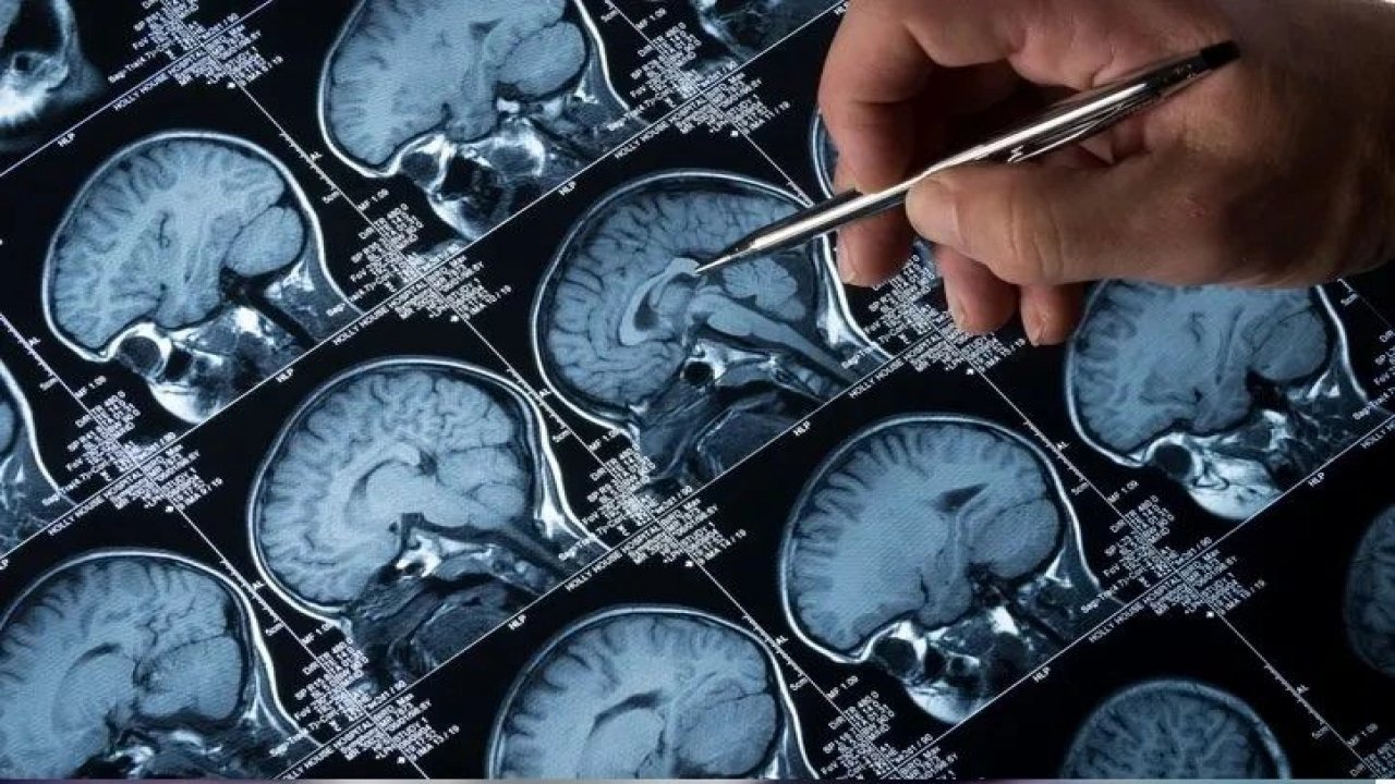 Beyni eriten iki yiyecek ortaya çıktı! Evinize sokmayın