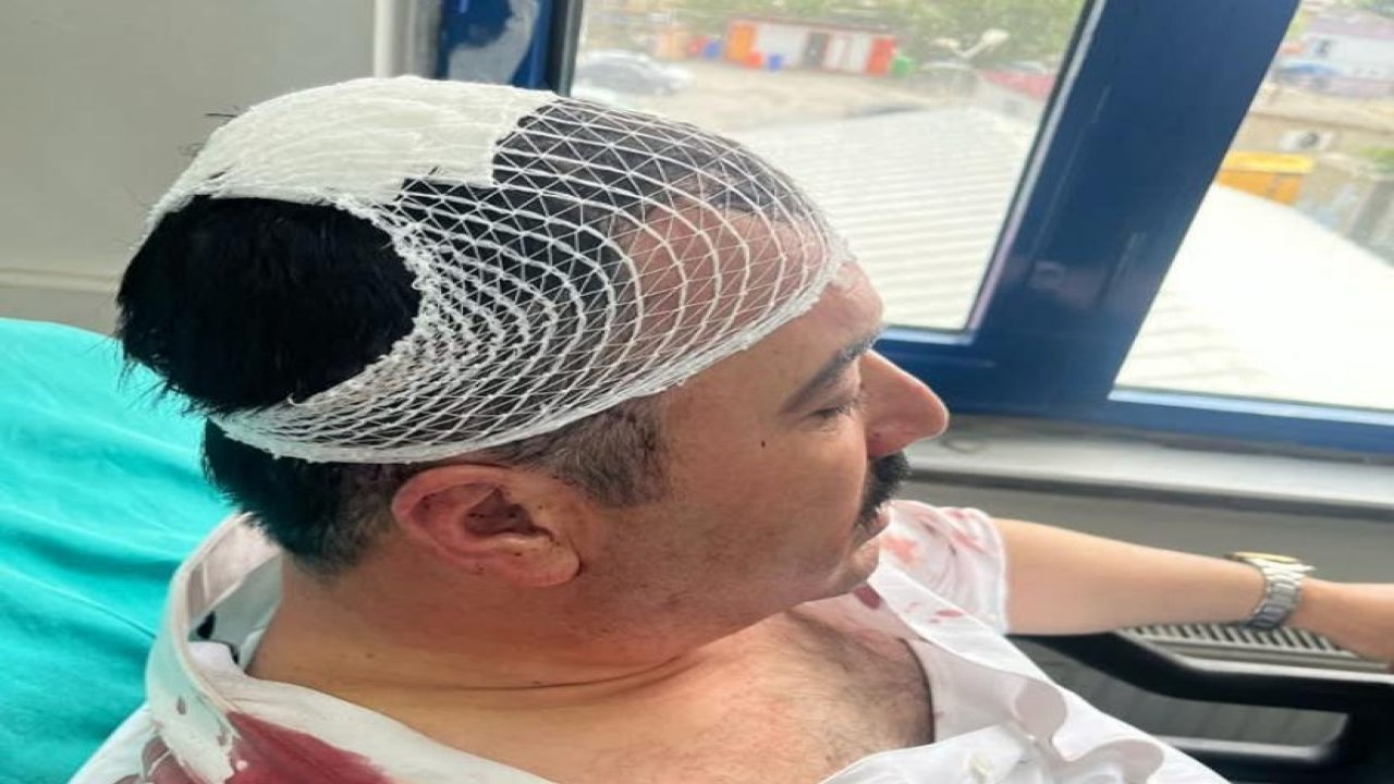 Kahramanmaraş’ta belediye başkan yardımcısına saldırı!