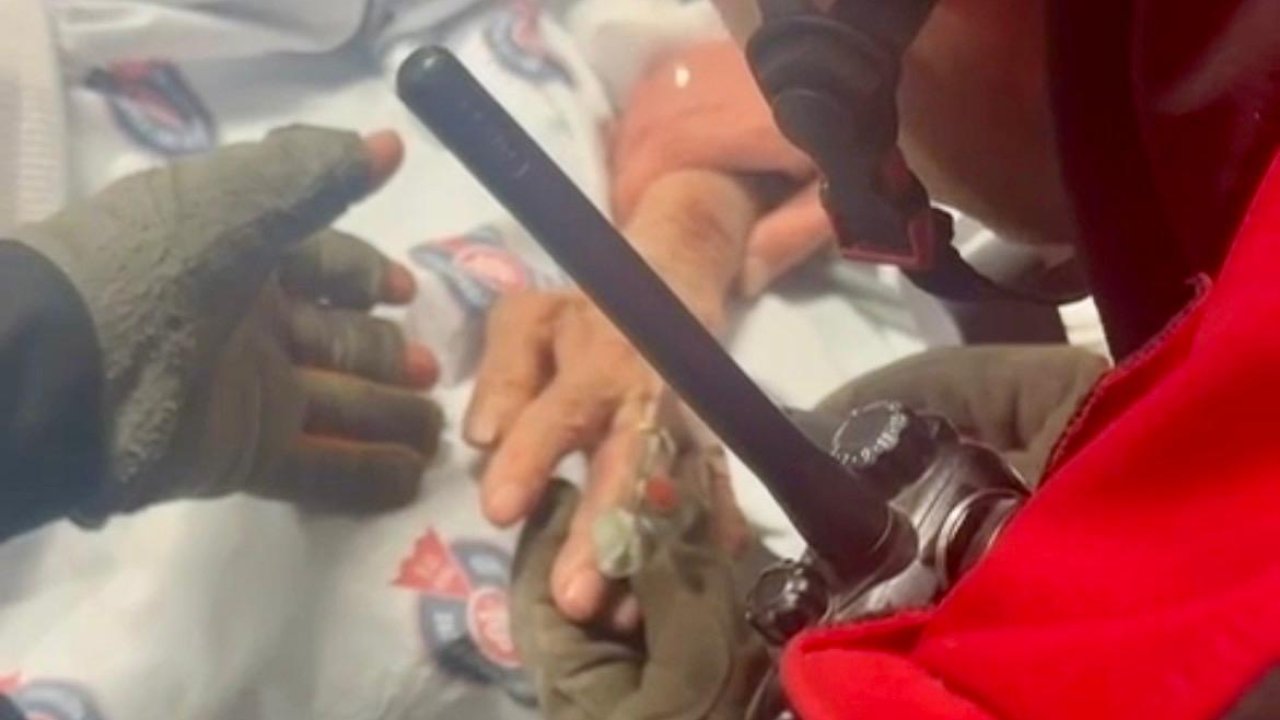 Kahramanmaraş’ta hastanın yüzüğü itfaiye ekiplerince çıkarıldı!