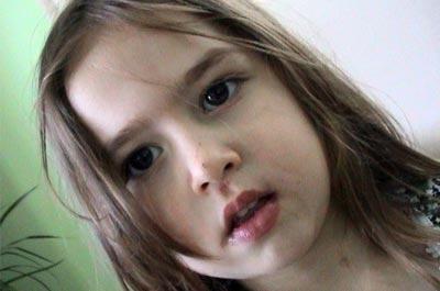 Kreşte düşen çocuğun yarasına resim çizdiler