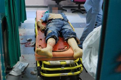 Minibüsün çarptığı çocuk öldü