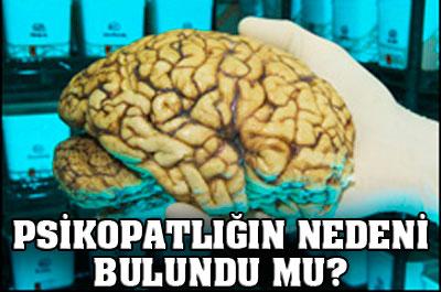 Psikopatlığın nedeni bulundu mu? 
