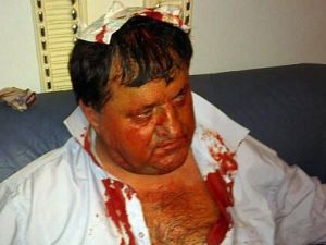 Ukrayna Parlamentosunda Kan Aktı