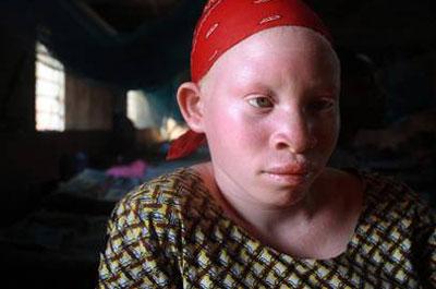 Albino satarken yakalandı