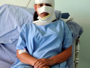 Saldırıya Uğrayan Genç Öğretmen Bu Hale Geldi