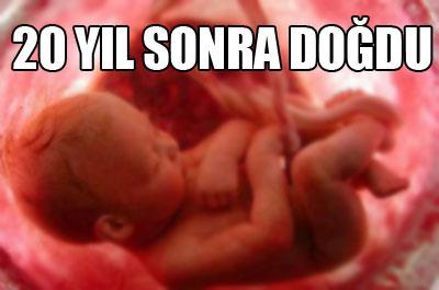 20 Yaşında Dünyaya Geldi