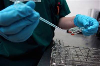 Yaşı Belirleyen Kan Testi