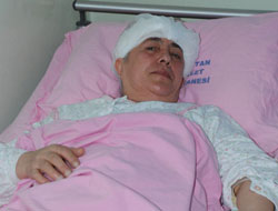 Elbistan’da İlk Beyin Tümörü Ameliyatı