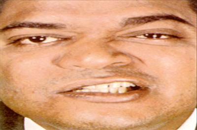 Yüz Felci Olabilirsiniz