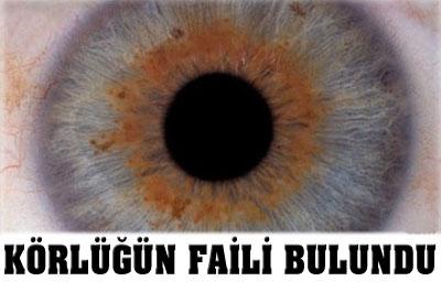 Körlüğün Faili Belli Oldu