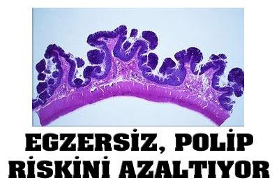 Egzersiz, Polip Riskini Azaltıyor