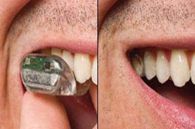 Ağzın İçindeki Kulak