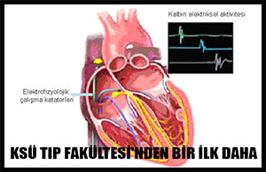 Ksü Tıp Fakültesinden Bir İlk Daha
