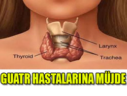 Guatr Ameliyatsız Tedavi Edilecek