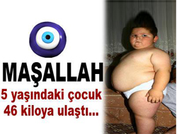 5 yaşındaki çocuk 46 kiloya ulaştı 