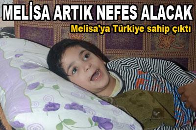 Melisa artık nefes alacak 