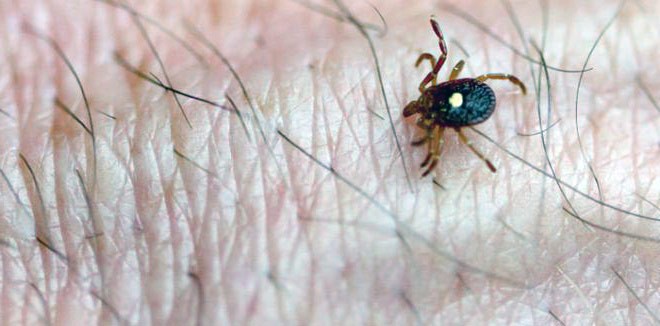 Keneden Yılın İlk Ölümü