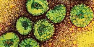 Fransa’da sars paniği