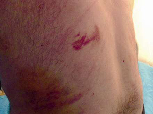 Define İçin Korkunç İşkence